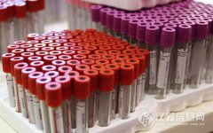 獨(dú)立醫(yī)學(xué)實(shí)驗(yàn)室：從216家增至356家，未來五年市場(chǎng)再添200億..